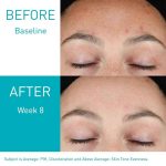 سرم رتینول بازسازی‌کننده پوست سراوی (Resurfacing Retinol)