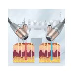 آکوافیشیال 11‌کاره مکس ایتالیا مدل FQ061