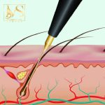 نئوهیدرودرمی فیرمینگ (گالوانیک) پویان تجهیز - Image 4