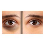 ژل دور چشم دپی وایت ای سی ام (15 میل) - Image 3