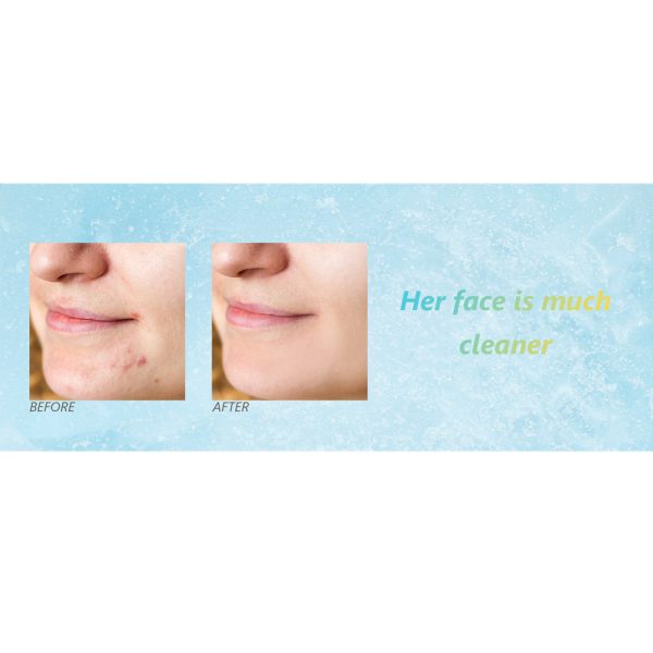 ماسک ال ای دی نقابی (ماسک LED صورت و گردن) 7 رنگ نور - Image 7