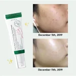 سرم ضد لک اکسیس وای - Image 3