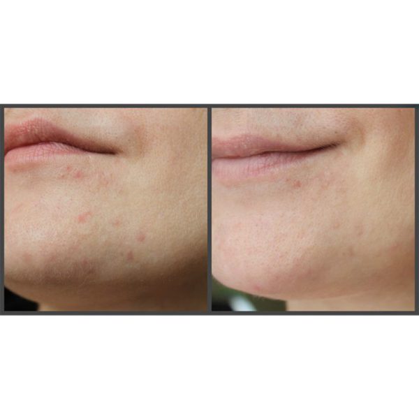 کرم مرطوب کننده و روشن کننده I’m From Rice - Image 7