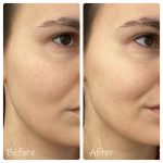 تونر روشن کننده ماداگاسکار سنتلا هیالو سیکا اسکین 1004 - Image 3