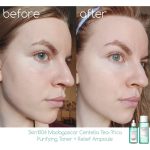 آمپول سنتلا ماداگاسکار تسکین دهنده چای تریکا اسکین 1004 - Image 3