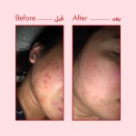 کرم ترمیم کننده معجزه آسای حلزون ترویسیکا Some By Mi - Image 4