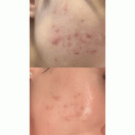 سرم جوانساز رتینول Some By Mi - Image 3