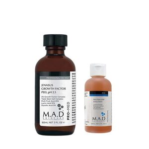 اسید جناسوس با محلول خنثی ساز ام ای دی